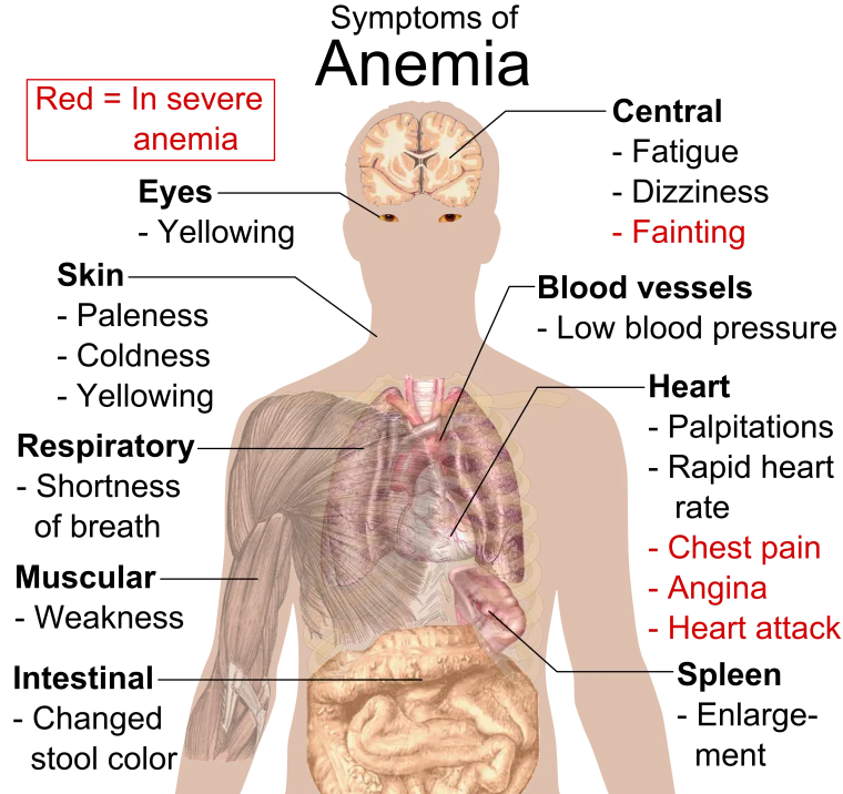 Read more about the article Aneemia – mis see on, sümptomid ja ravimispõhimõtted